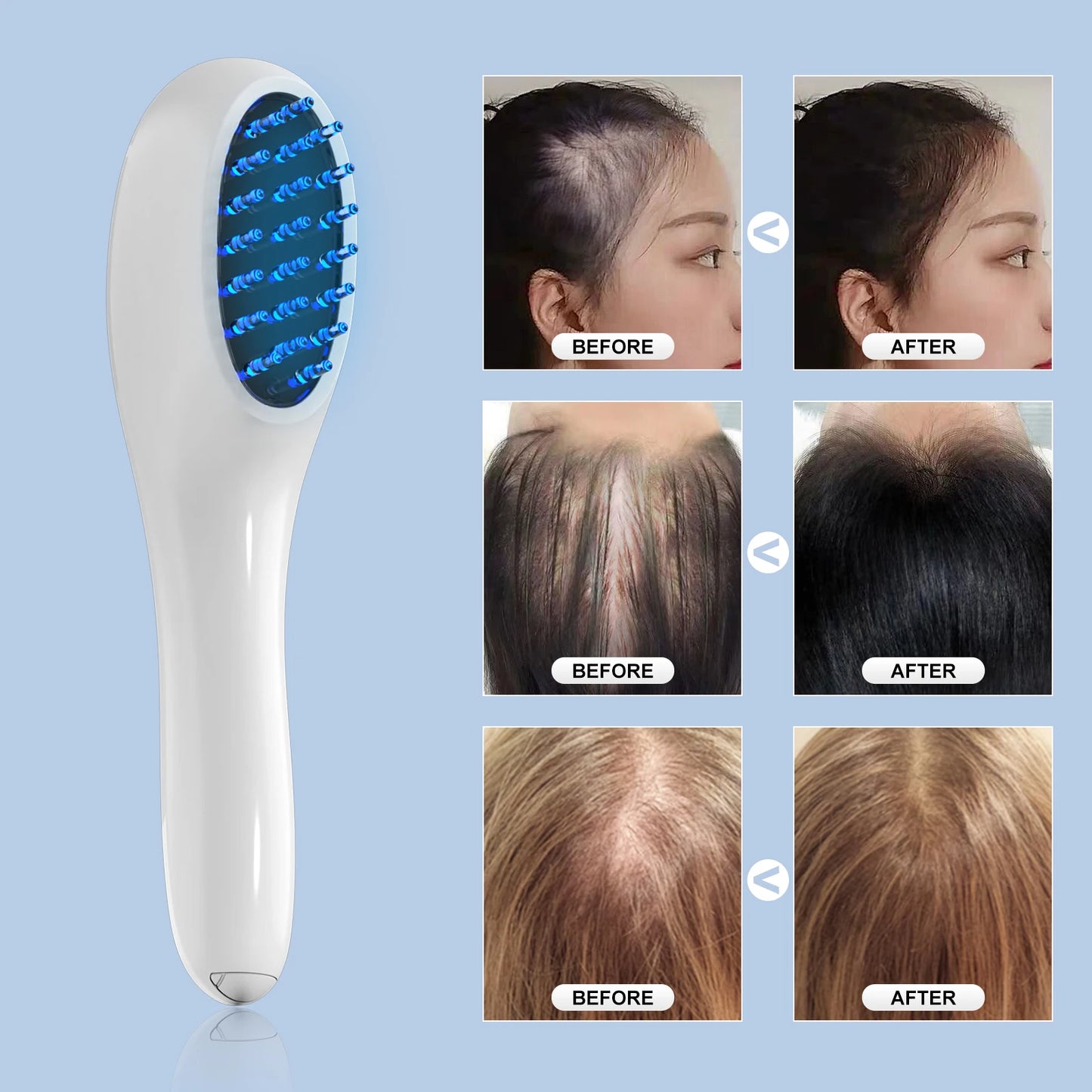 Peigne Électrique LED — Tête peigne avec LEDs — SCALPIA