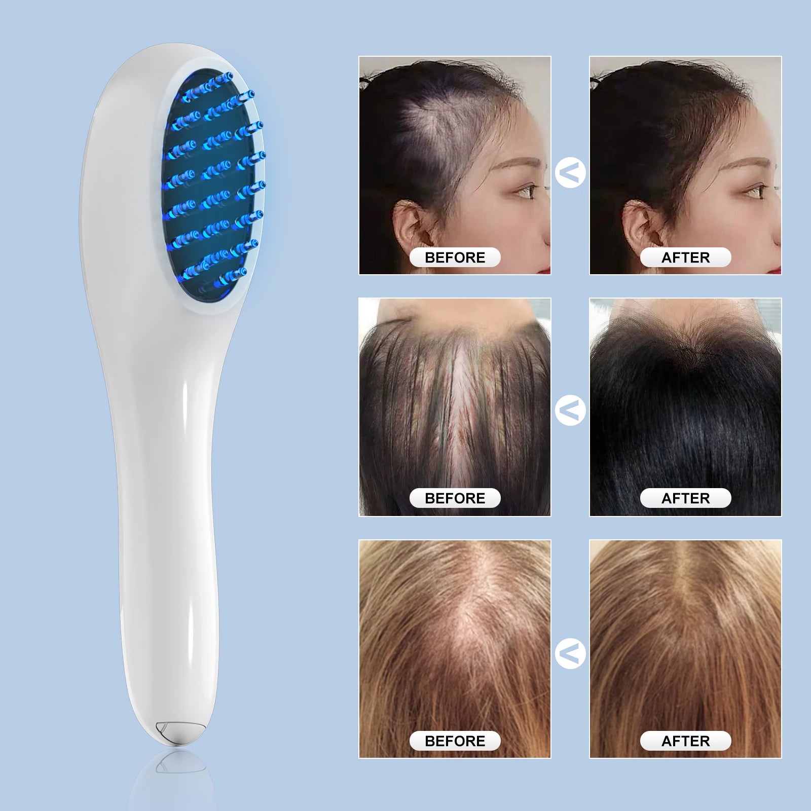 Peigne Électrique LED — Tête peigne avec LEDs — SCALPIA
